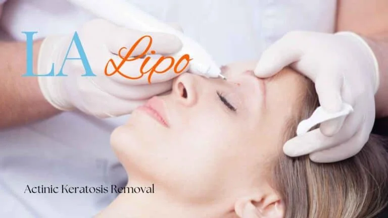 Woman receiving Actinic Keratosis Removal Treatment Longbridge