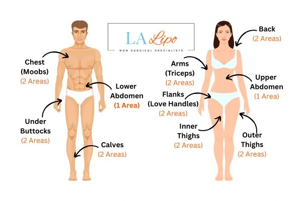 LA LIPO Cryolipolysis Areas Longbridge