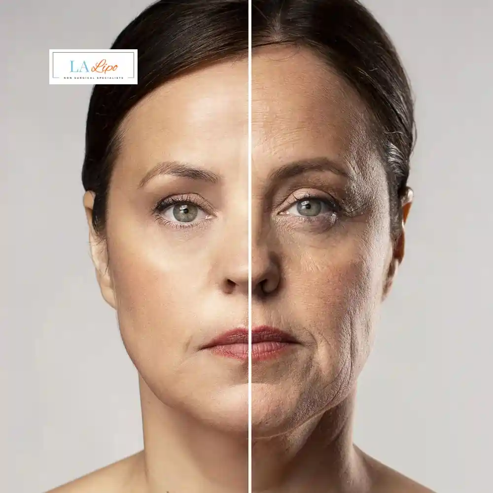 How Can You Tell If Non-Surgical Skin Tightening Is Right for You Longbridge?