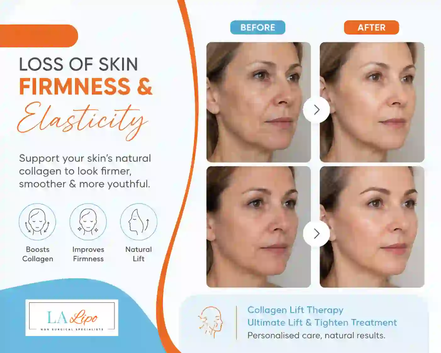Sign #7: Loss of Skin Firmness and Elasticity Longbridge