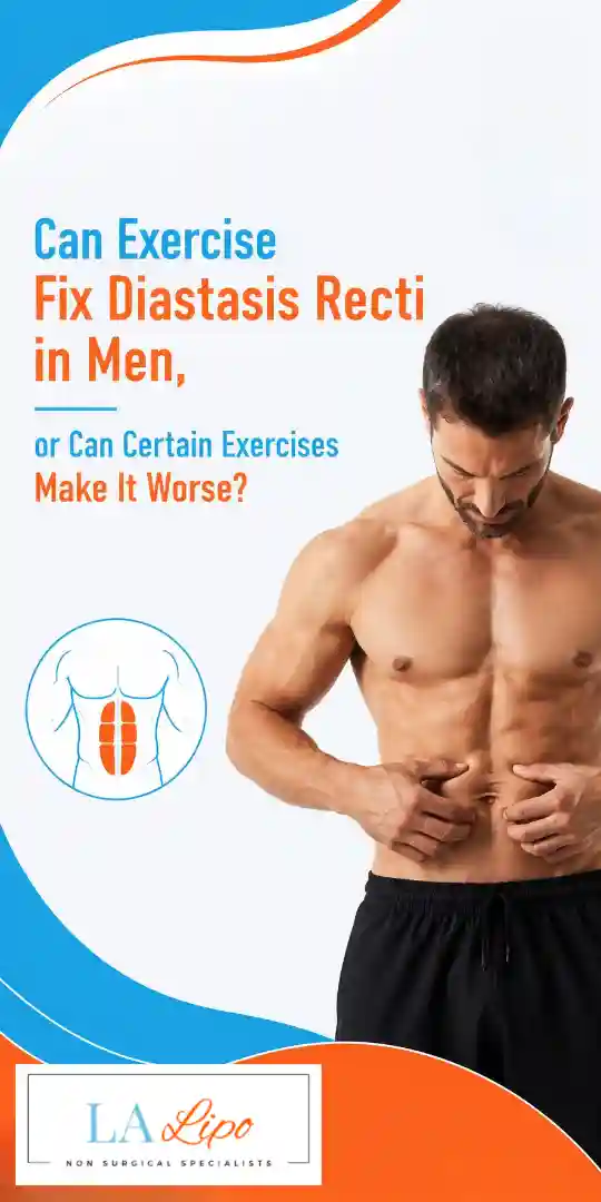 Can Exercise Fix Diastasis Recti in Men, or Can Certain Exercises Make It Worse Longbridge?